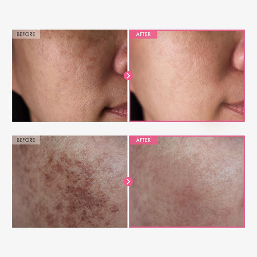 Korean Clinical Arbutin Brightening Cream