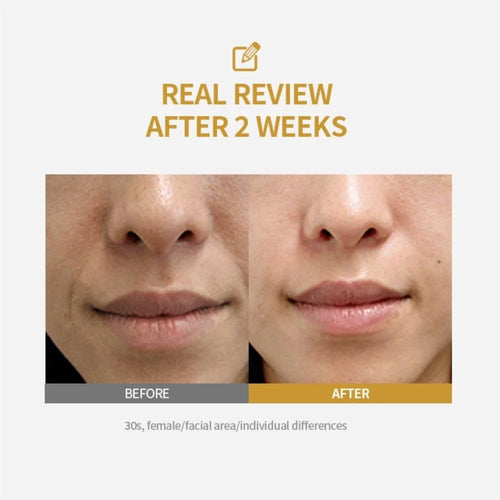 Kojic Acid Niacinamide Brightening Serum